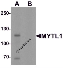 Western blot analysis of MYT1L in mouse brain tissue lysate with MYT1L antibody at 1 μg/mL in (A) the absence and (B) the presence of blocking peptide.