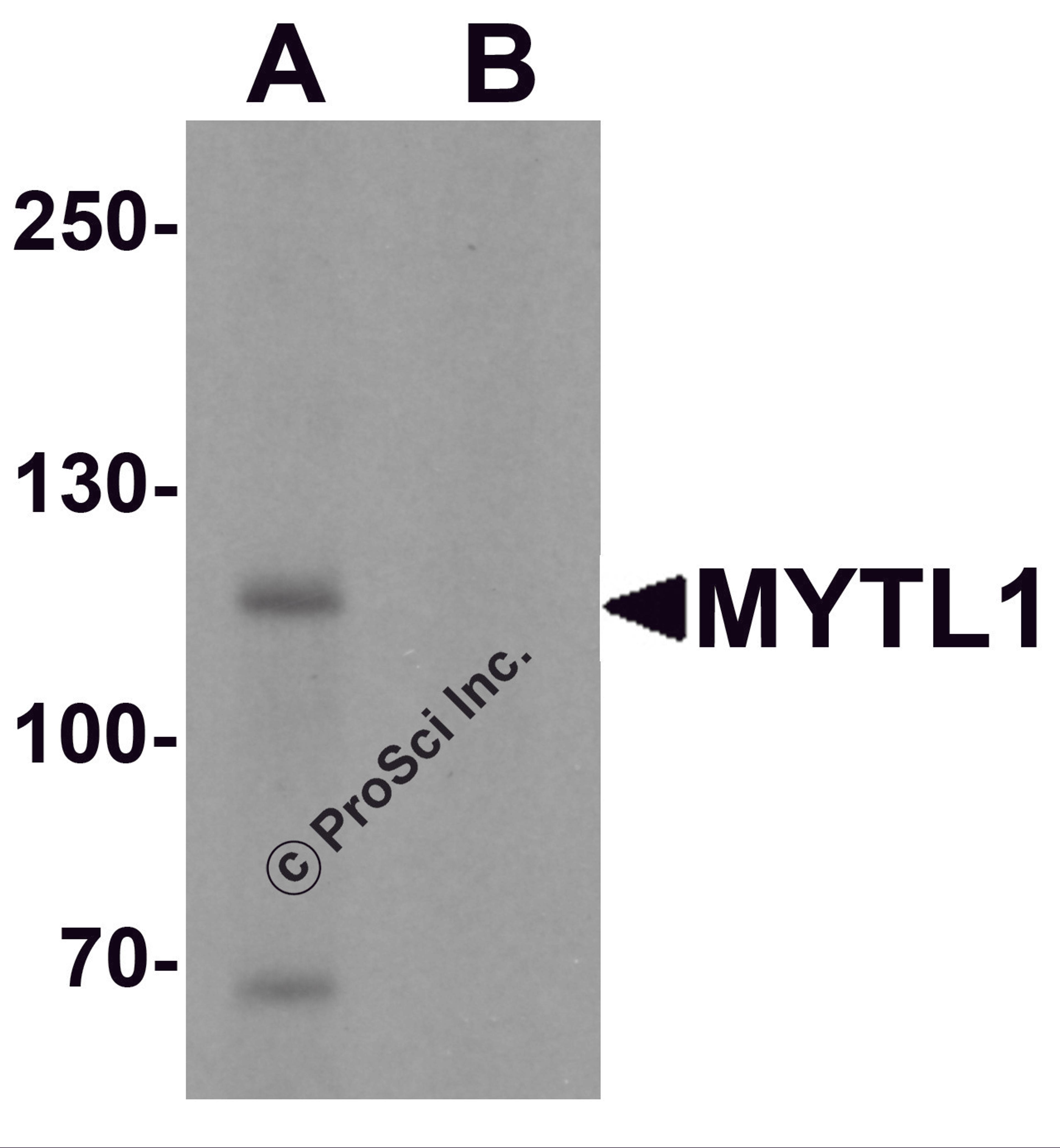 Western blot analysis of MYT1L in mouse brain tissue lysate with MYT1L antibody at 1 μg/mL in (A) the absence and (B) the presence of blocking peptide.