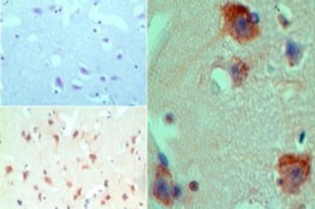 Immunohistochemistry-Paraffin: HDAC9 Antibody [NBP2-03993] - Analysis of HDAC-9 in formalin-fixed, paraffin-embedded human brain tissue using an isotype control (top left) and NBP2-03993 (bottom left, right) at 5 ug/ml.