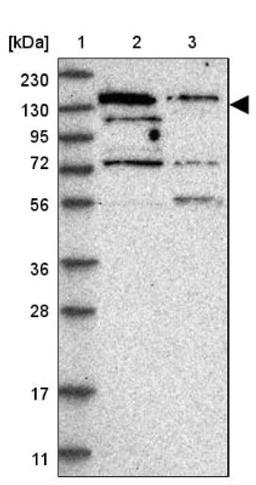 Western Blot: RBM6 Antibody [NBP1-89376] - Lane 1: Marker [kDa] 230, 130, 95, 72, 56, 36, 28, 17, 11<br/>Lane 2: Human cell line RT-4<br/>Lane 3: Human cell line U-251MG sp