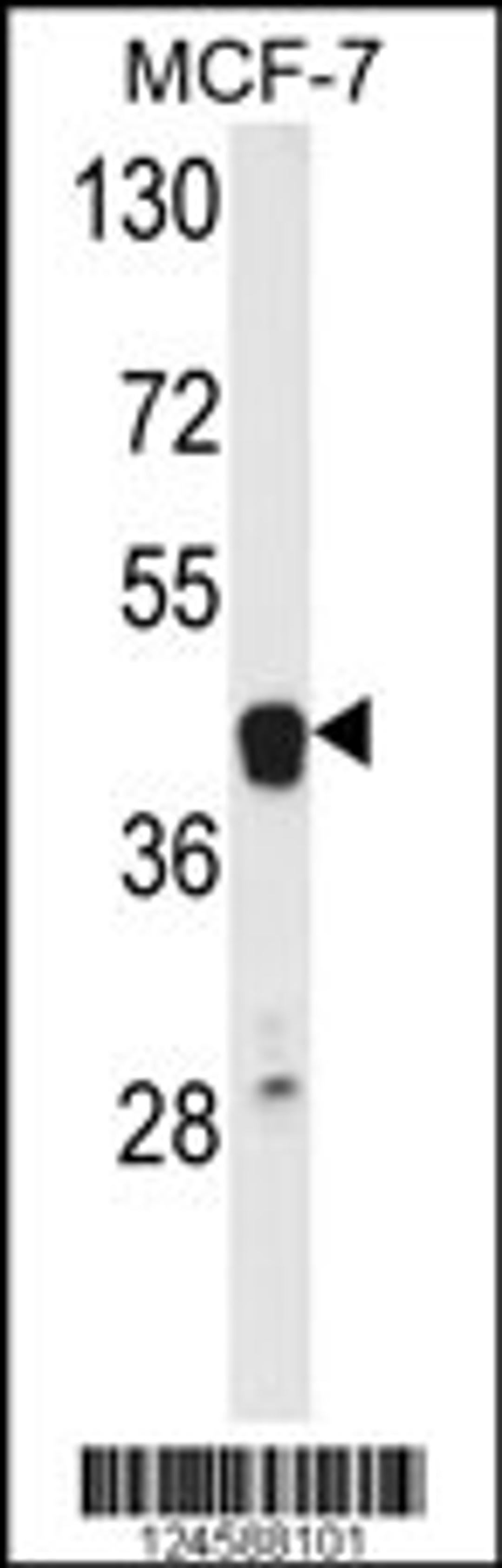 Western blot analysis of ETS2 Antibody in MCF-7 cell line lysates (35ug/lane)