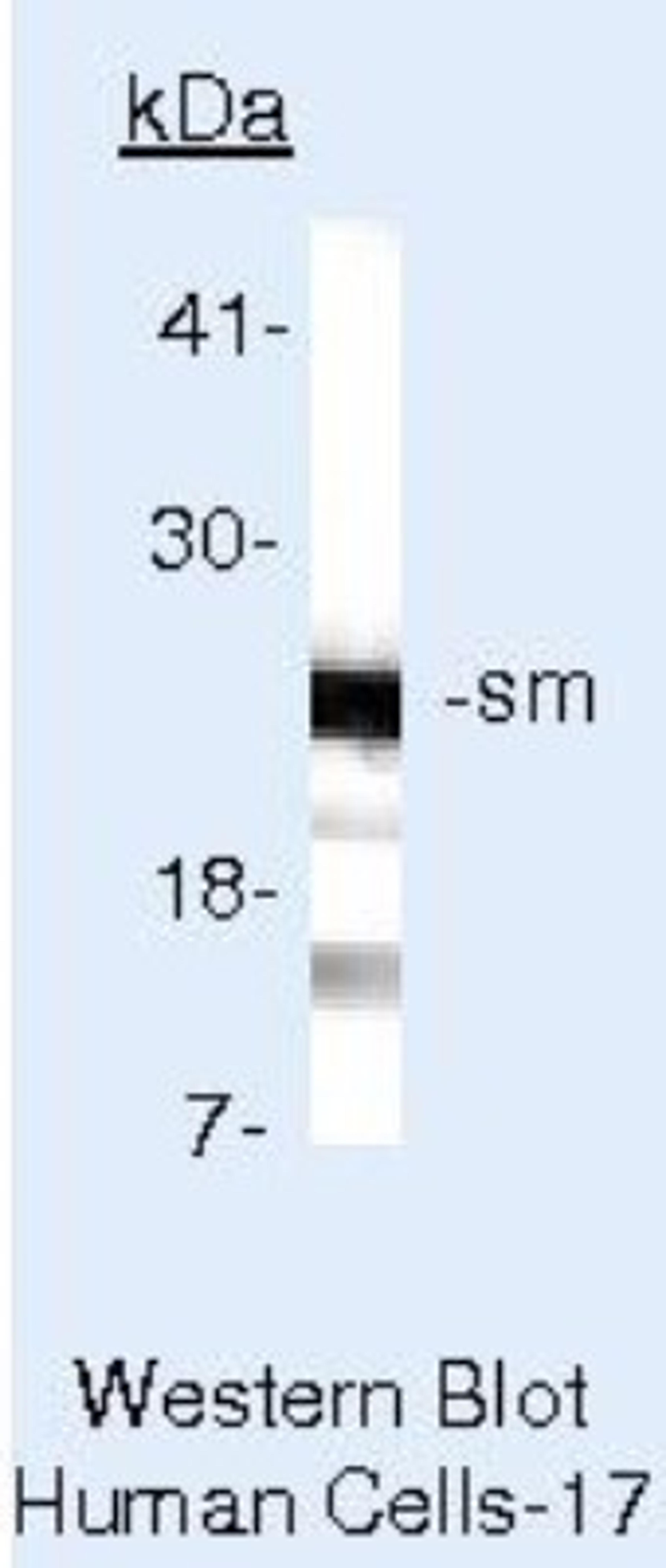 Western Blot: Smith Antigen Antibody (Y12) [NB600-546] - Analysis of LS174T Cells.