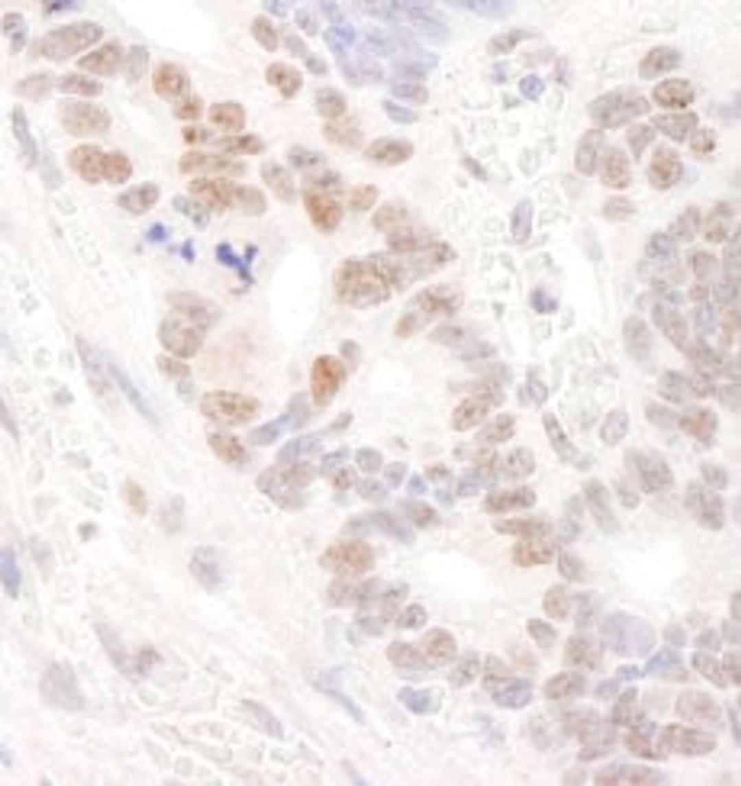 Detection of human DDX24 by immunohistochemistry.