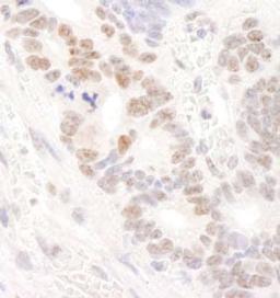 Detection of human DDX24 by immunohistochemistry.