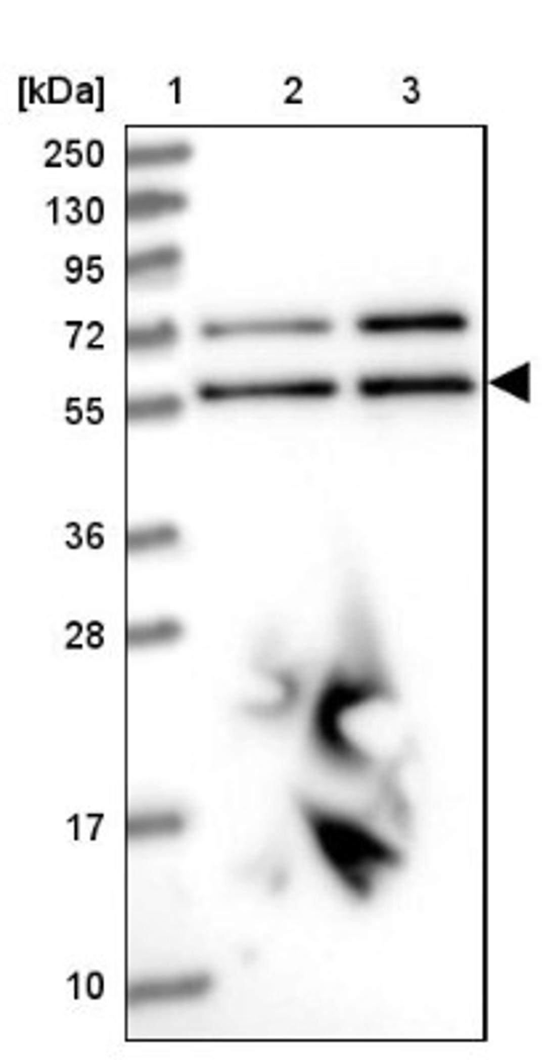 Western Blot: LAP1B Antibody [NBP2-47402] - Lane 1: Marker [kDa] 250, 130, 95, 72, 55, 36, 28, 17, 10.  Lane 2: Human cell line RT-4.  Lane 3: Human cell line U-251MG.