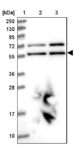 Western Blot: LAP1B Antibody [NBP2-47402] - Lane 1: Marker [kDa] 250, 130, 95, 72, 55, 36, 28, 17, 10.  Lane 2: Human cell line RT-4.  Lane 3: Human cell line U-251MG.