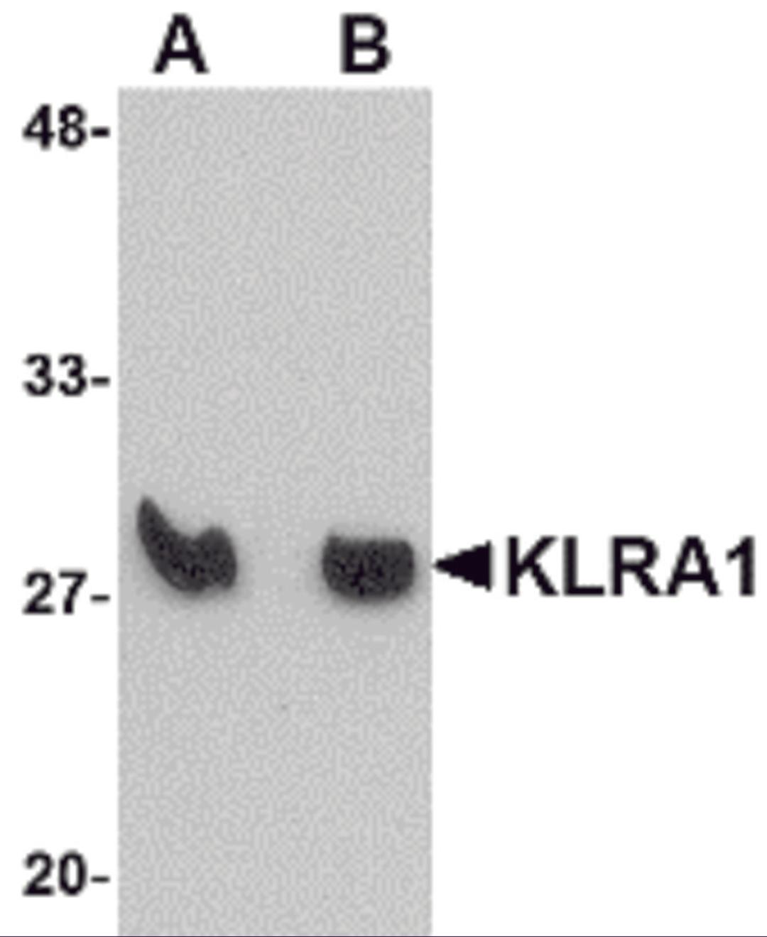 Western blot analysis of KLRA1 in mouse spleen tissue lysate with KLRA1 antibody at (A) 1 μg/mL and (B) 2 μg/mL.