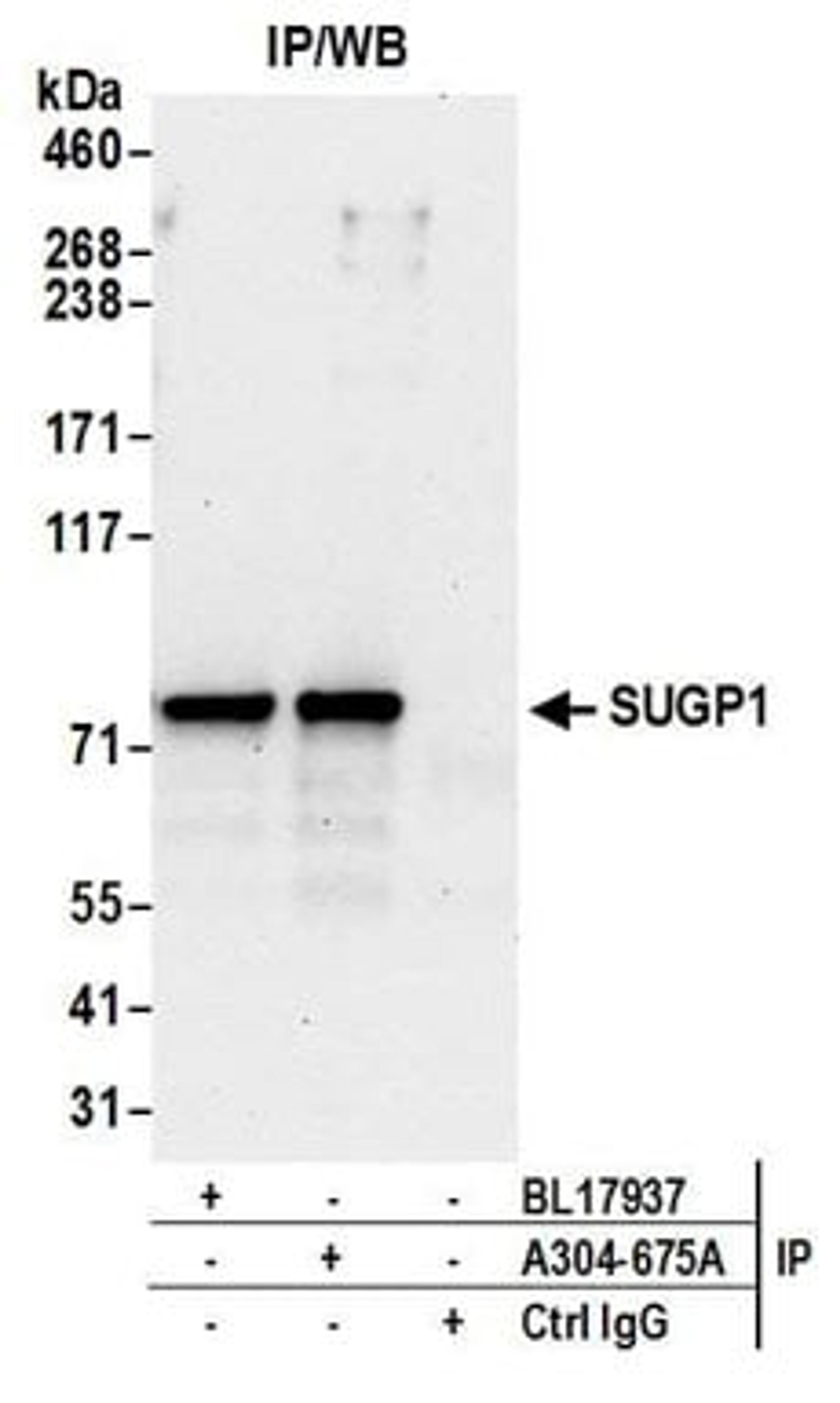 Detection of human SUGP1 by western blot of immunoprecipitates.