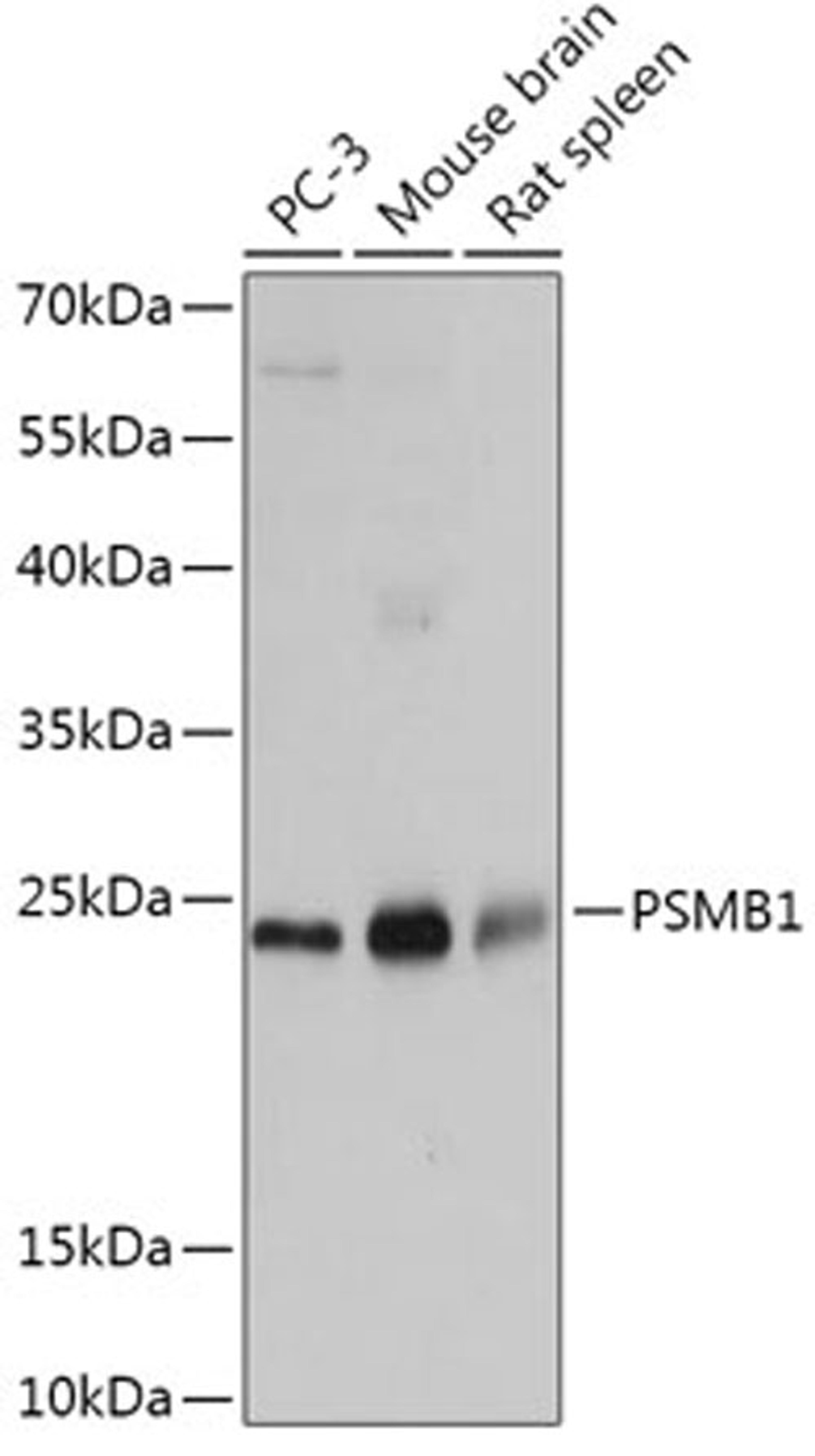 Western blot - PSMB1 antibody (A1043)