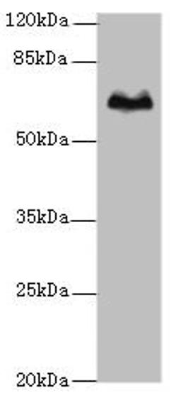 Western blot. All lanes: TBX15 antibody at 5µg/ml + Hela whole cell lysate. Secondary. Goat polyclonal to rabbit IgG at 1/10000 dilution. Predicted band size: 66, 55 kDa. Observed band size: 66 kDa