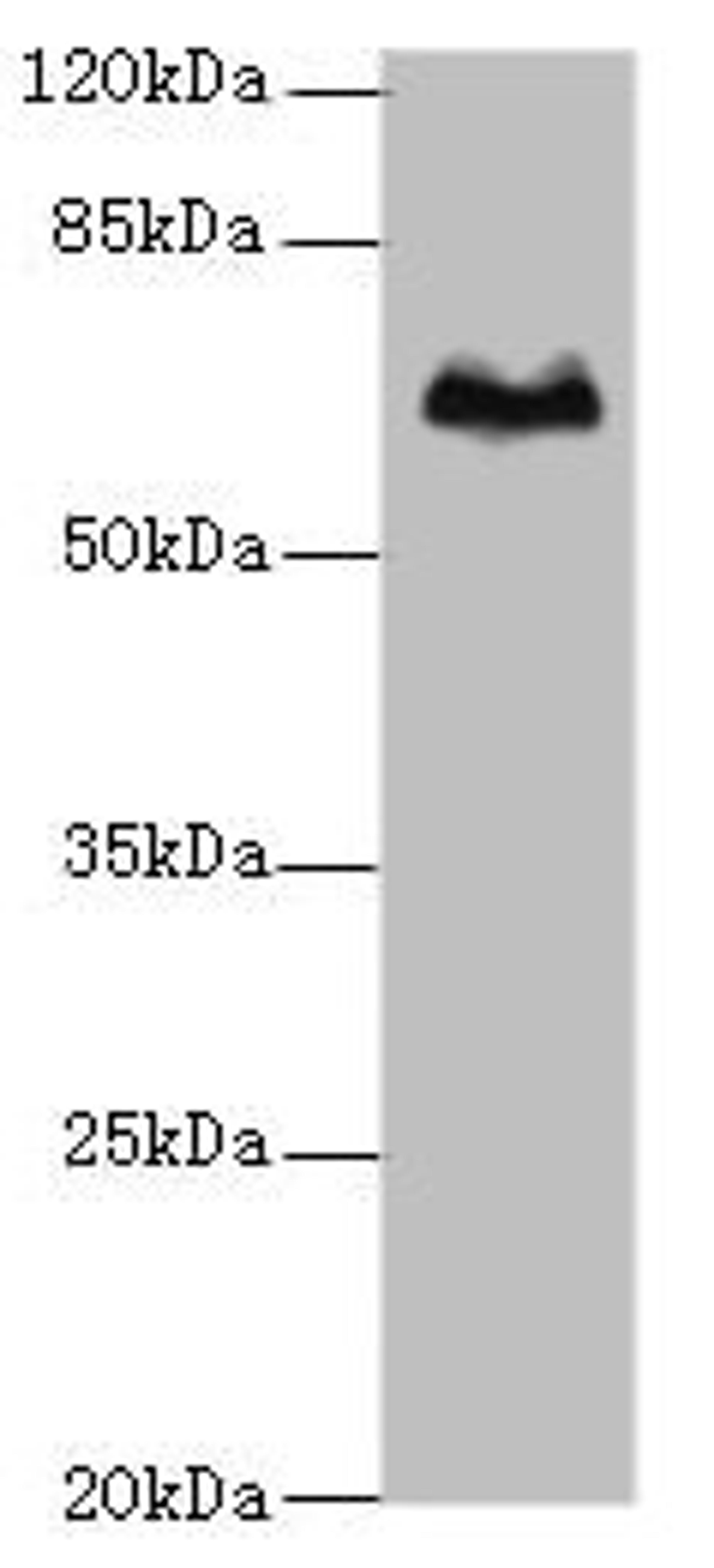 Western blot. All lanes: TBX15 antibody at 5µg/ml + Hela whole cell lysate. Secondary. Goat polyclonal to rabbit IgG at 1/10000 dilution. Predicted band size: 66, 55 kDa. Observed band size: 66 kDa