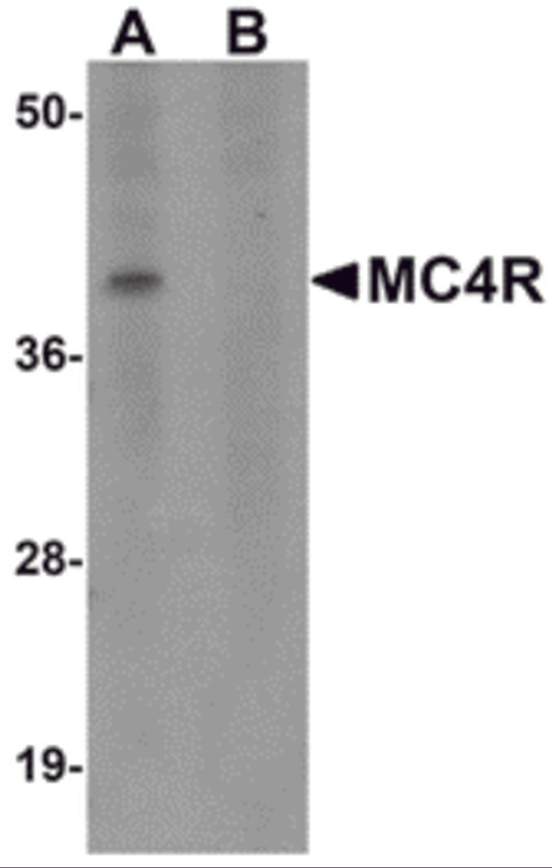 Western blot analysis of MC4R in rat brain tissue lysate with MC4R antibody at 1 μg/mL in (A) the absence and (B) the presence of blocking peptide.