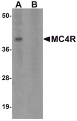 Western blot analysis of MC4R in rat brain tissue lysate with MC4R antibody at 1 μg/mL in (A) the absence and (B) the presence of blocking peptide.