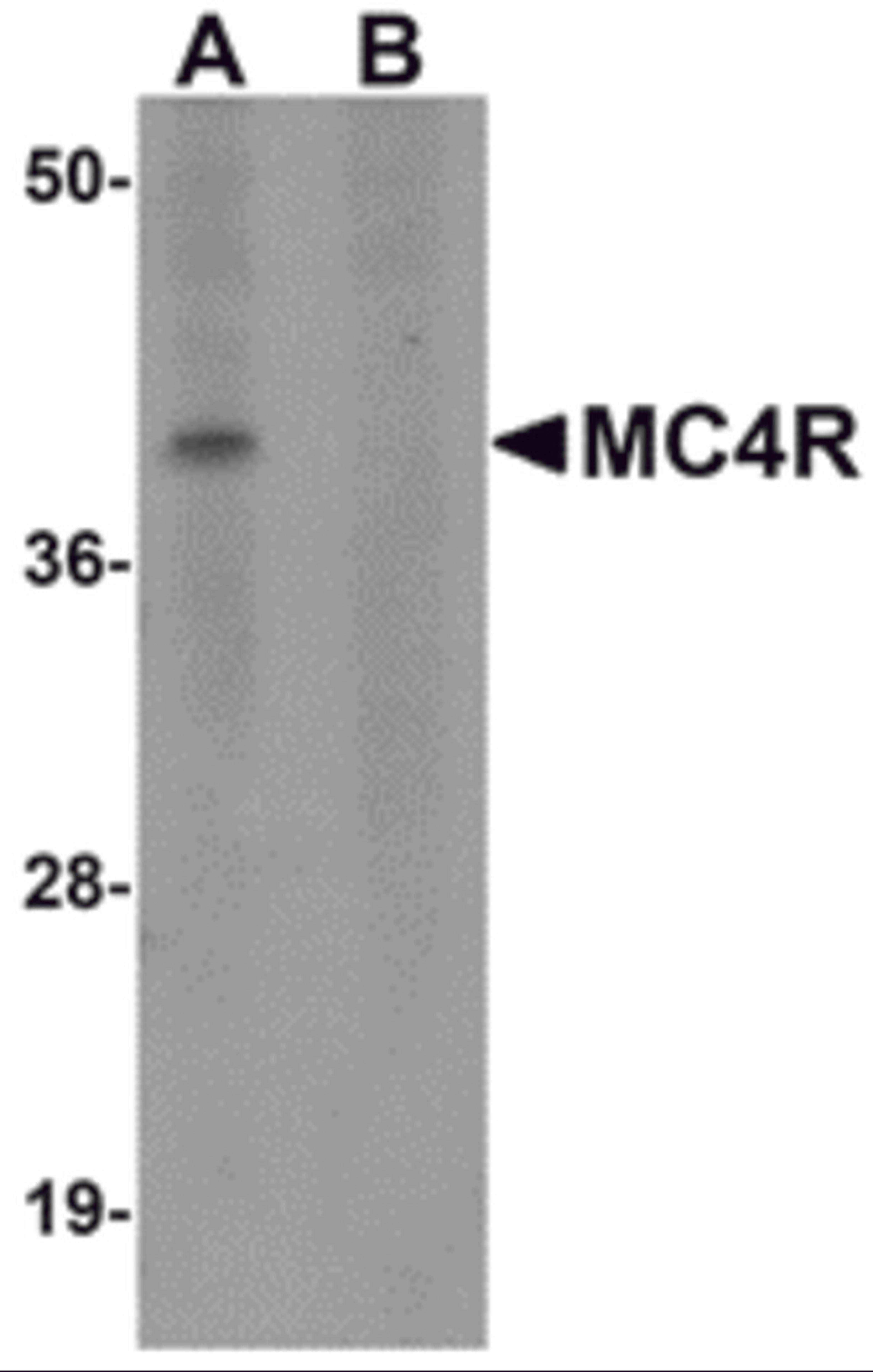 Western blot analysis of MC4R in rat brain tissue lysate with MC4R antibody at 1 μg/mL in (A) the absence and (B) the presence of blocking peptide.