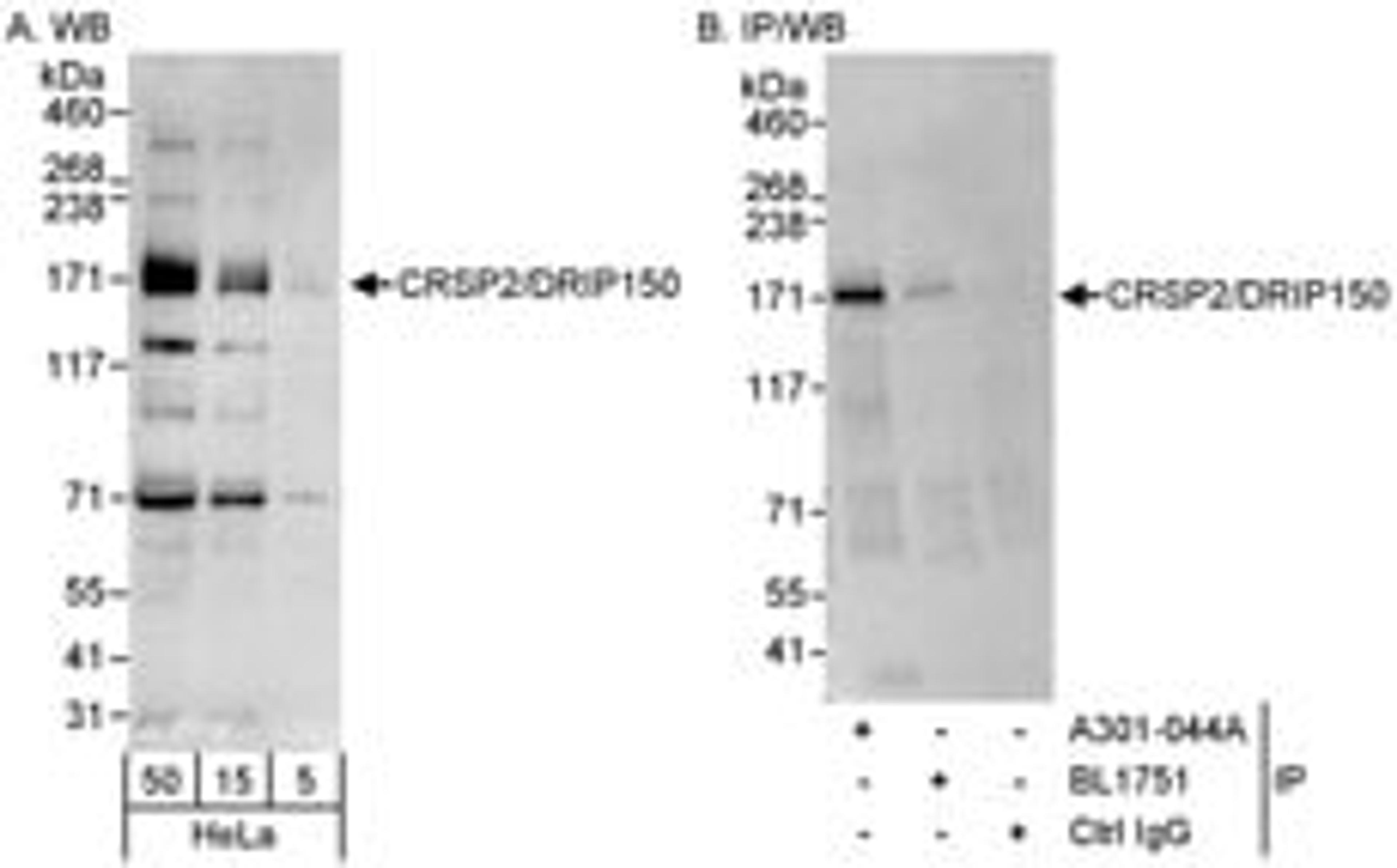 Detection of human CRSP2/DRIP150 by western blot and immunoprecipitation.