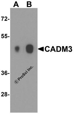 Western blot analysis of CADM3 in human brain tissue lysate with CADM3 antibody at (A) 1 and (B) 2 μg/ml.