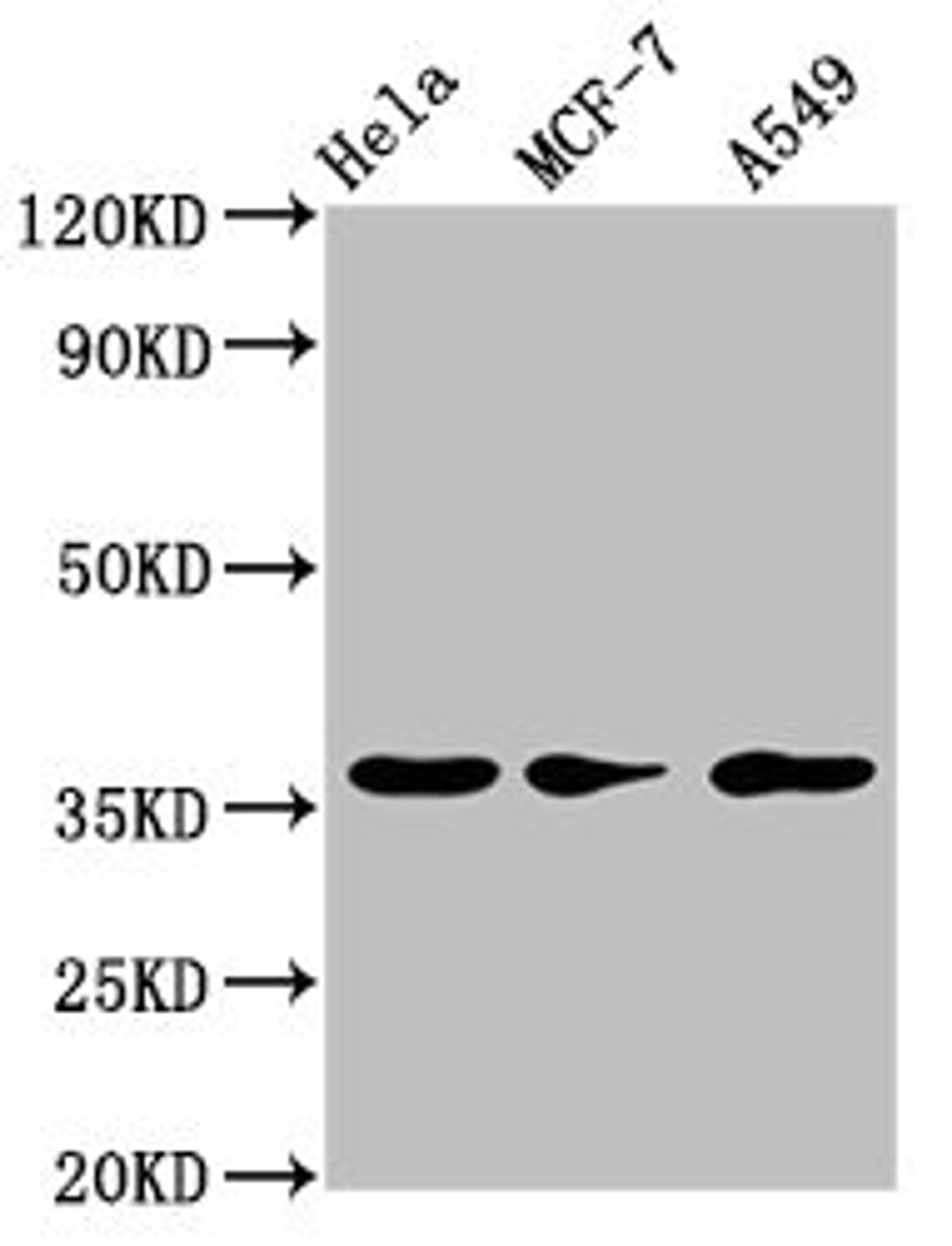 Western Blot. Positive WB detected in: Hela whole cell lysate, MCF-7 whole cell lysate, A549 whole cell lysate. All lanes: RCE1 antibody at 3.2µg/ml. Secondary. Goat polyclonal to rabbit IgG at 1/50000 dilution. Predicted band size: 36 kDa. Observed band size: 36 kDa