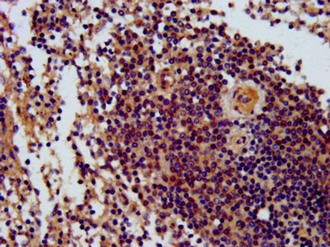 IHC image of CSB-PA613425LA01HU diluted at 1:300 and staining in paraffin-embedded human spleen tissue performed on a Leica BondTM system. After dewaxing and hydration, antigen retrieval was mediated by high pressure in a citrate buffer (pH 6.0). Section was blocked with 10% normal goat serum 30min at RT. Then primary antibody (1% BSA) was incubated at 4&deg;C overnight. The primary is detected by a biotinylated secondary antibody and visualized using an HRP conjugated SP system.