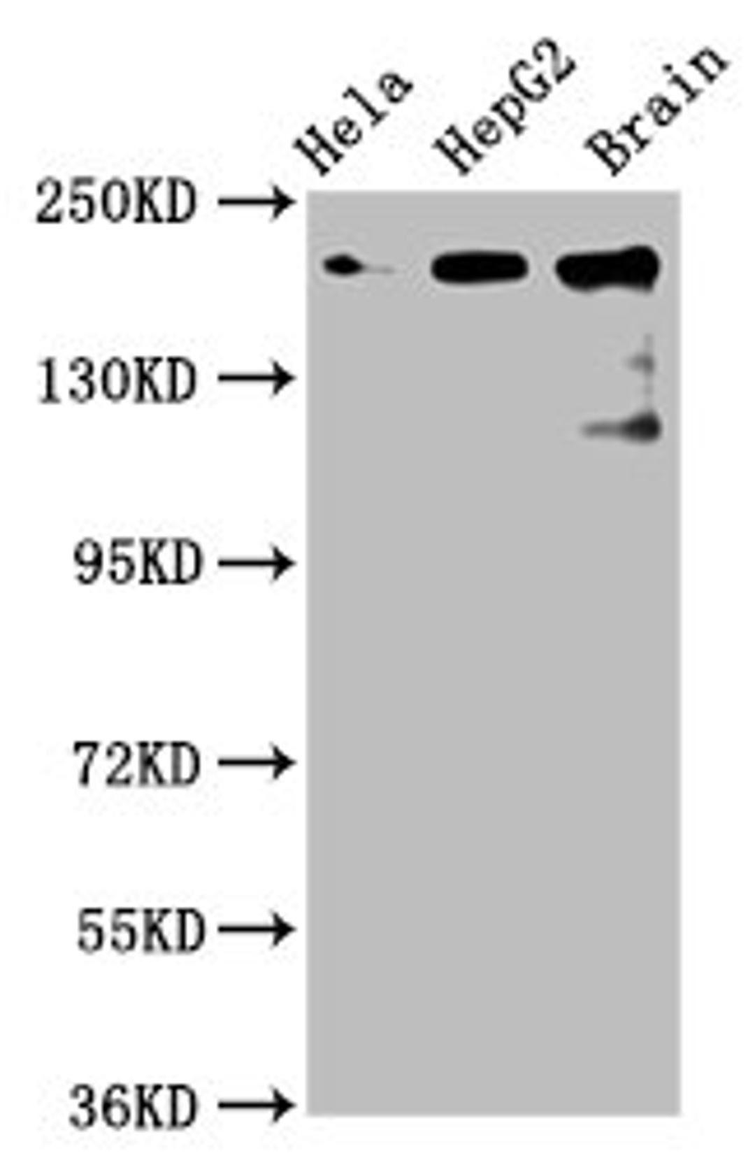 Western Blot. Positive WB detected in: Hela whole cell lysate, HepG2 whole cell lysate, Rat brain tissue. All lanes: CKAP5 antibody at 6µg/ml. Secondary. Goat polyclonal to rabbit IgG at 1/50000 dilution. Predicted band size: 226, 219, 227 kDa. Observed band size: 226 kDa