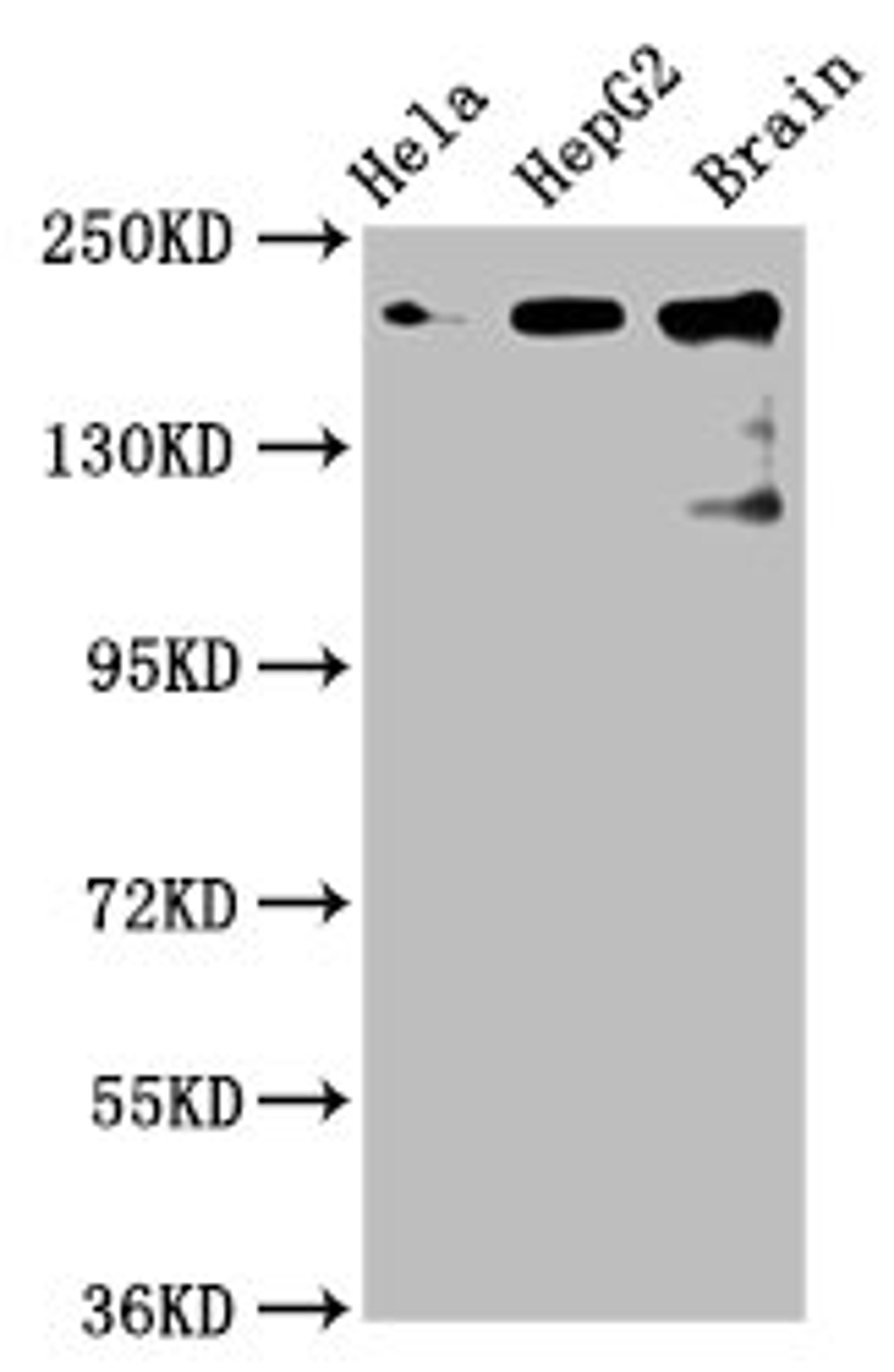Western Blot. Positive WB detected in: Hela whole cell lysate, HepG2 whole cell lysate, Rat brain tissue. All lanes: CKAP5 antibody at 6µg/ml. Secondary. Goat polyclonal to rabbit IgG at 1/50000 dilution. Predicted band size: 226, 219, 227 kDa. Observed band size: 226 kDa