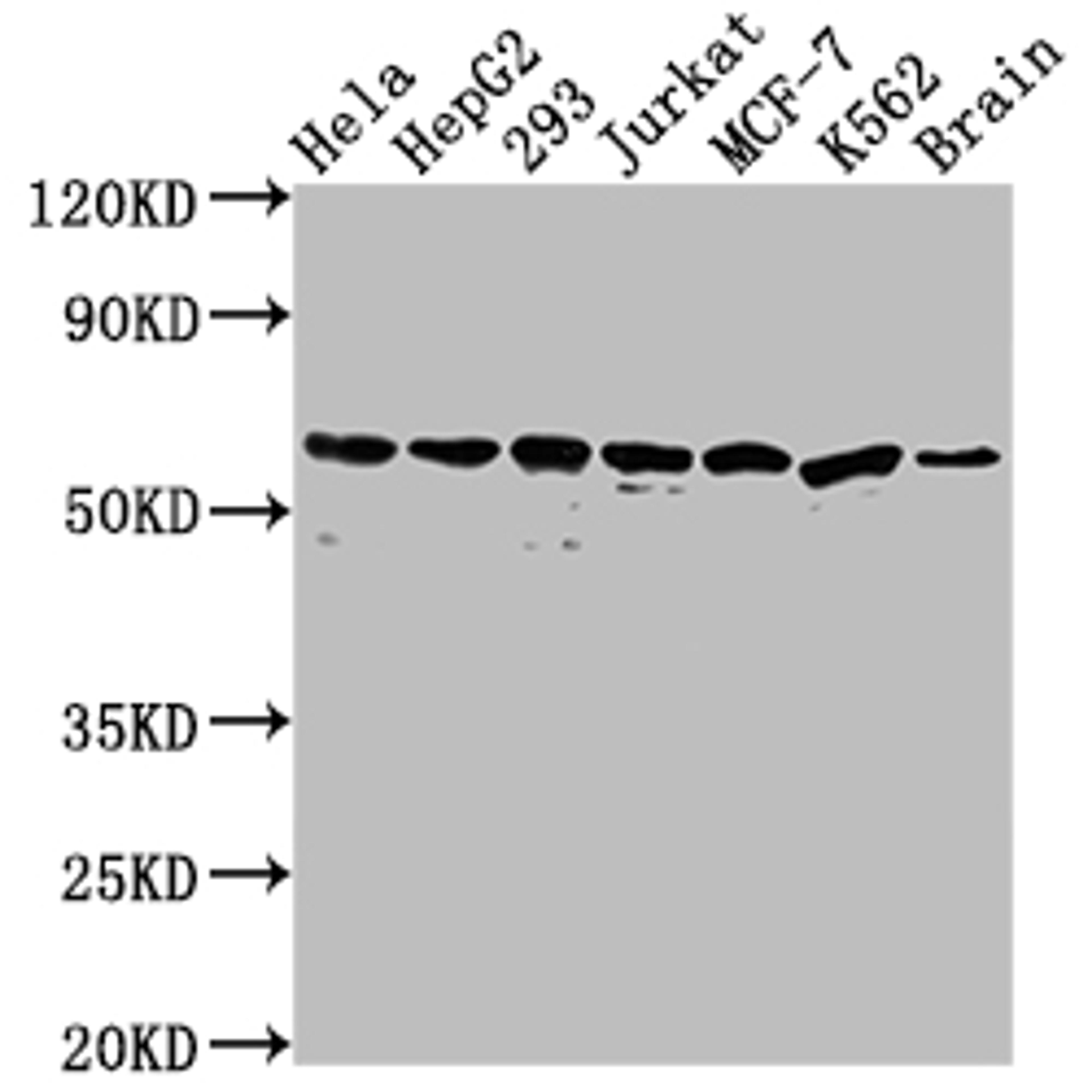 Western Blot. Positive WB detected in: Hela whole cell lysate, HepG2 whole cell lysate, 293 whole cell lysate, Jurkat whole cell lysate, MCF-7 whole cell lysate, K562 whole cell lysate, Mouse brain tissue. All lanes: HSPD1 antibody at 1:2000. Secondary. Goat polyclonal to rabbit IgG at 1/50000 dilution. Predicted band size: 62, 18 kDa. Observed band size: 60 kDa.