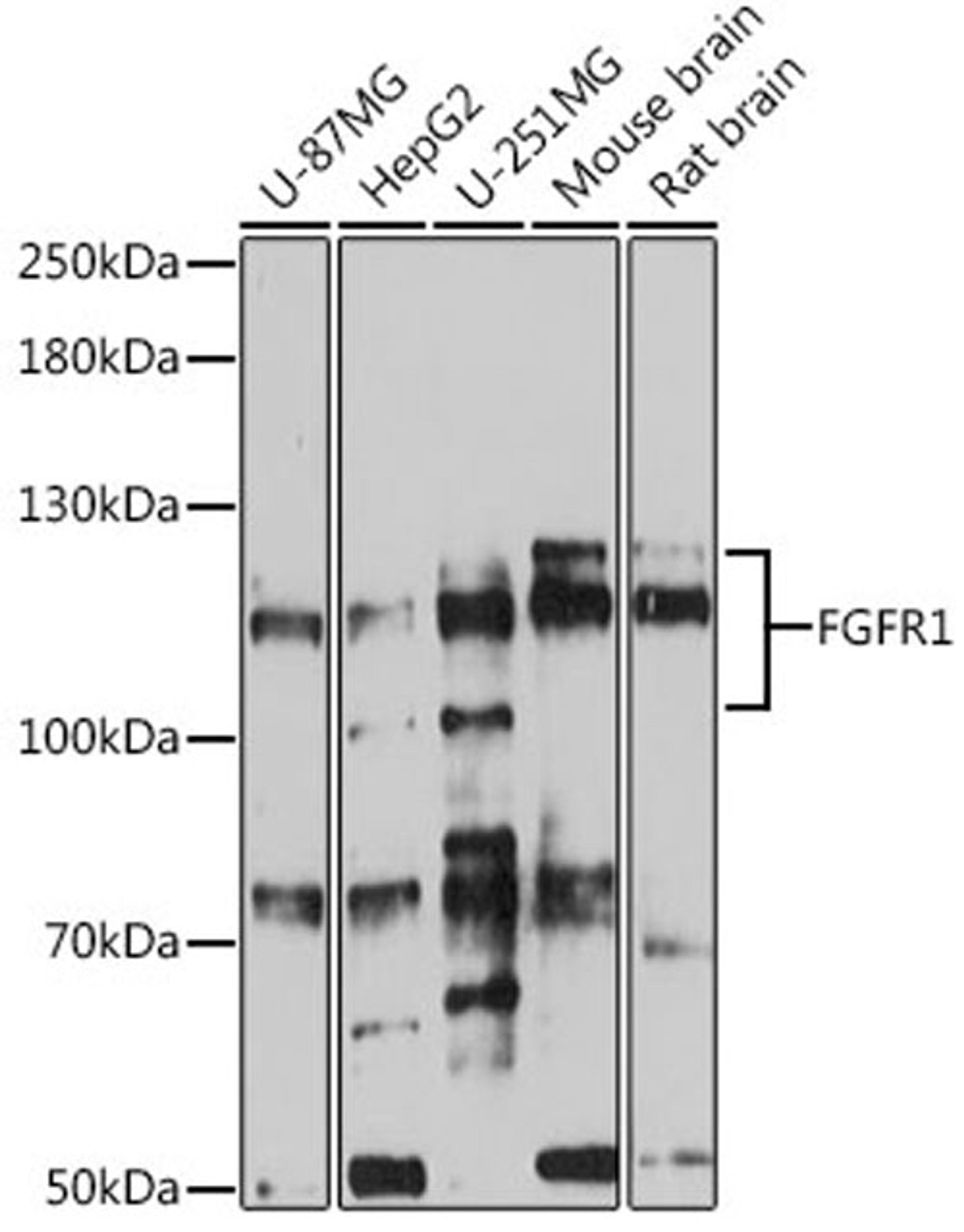 Western blot - FGFR1 antibody (A0082)