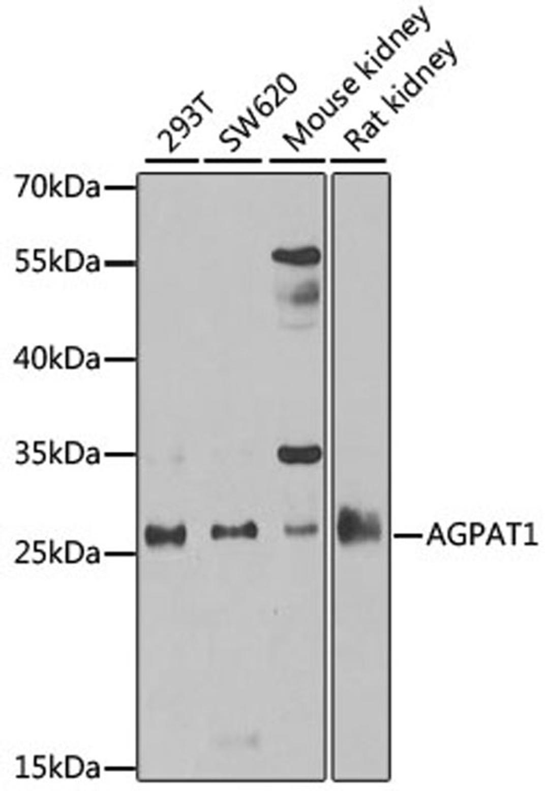 Western blot - AGPAT1 antibody (A6517)