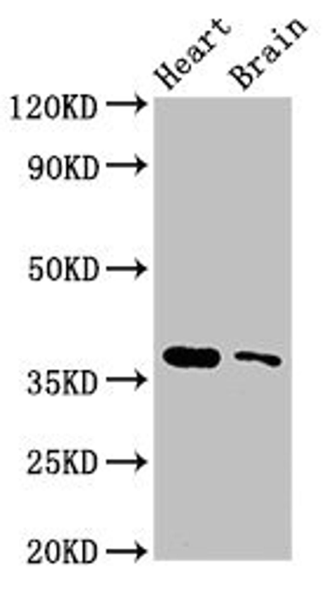 Western Blot. Positive WB detected in: Mouse heart tissue, Mouse brain tissue. All lanes: SRR antibody at 3ug/ml. Secondary. Goat polyclonal to rabbit IgG at 1/50000 dilution. Predicted band size: 37 kDa. Observed band size: 37 kDa. 