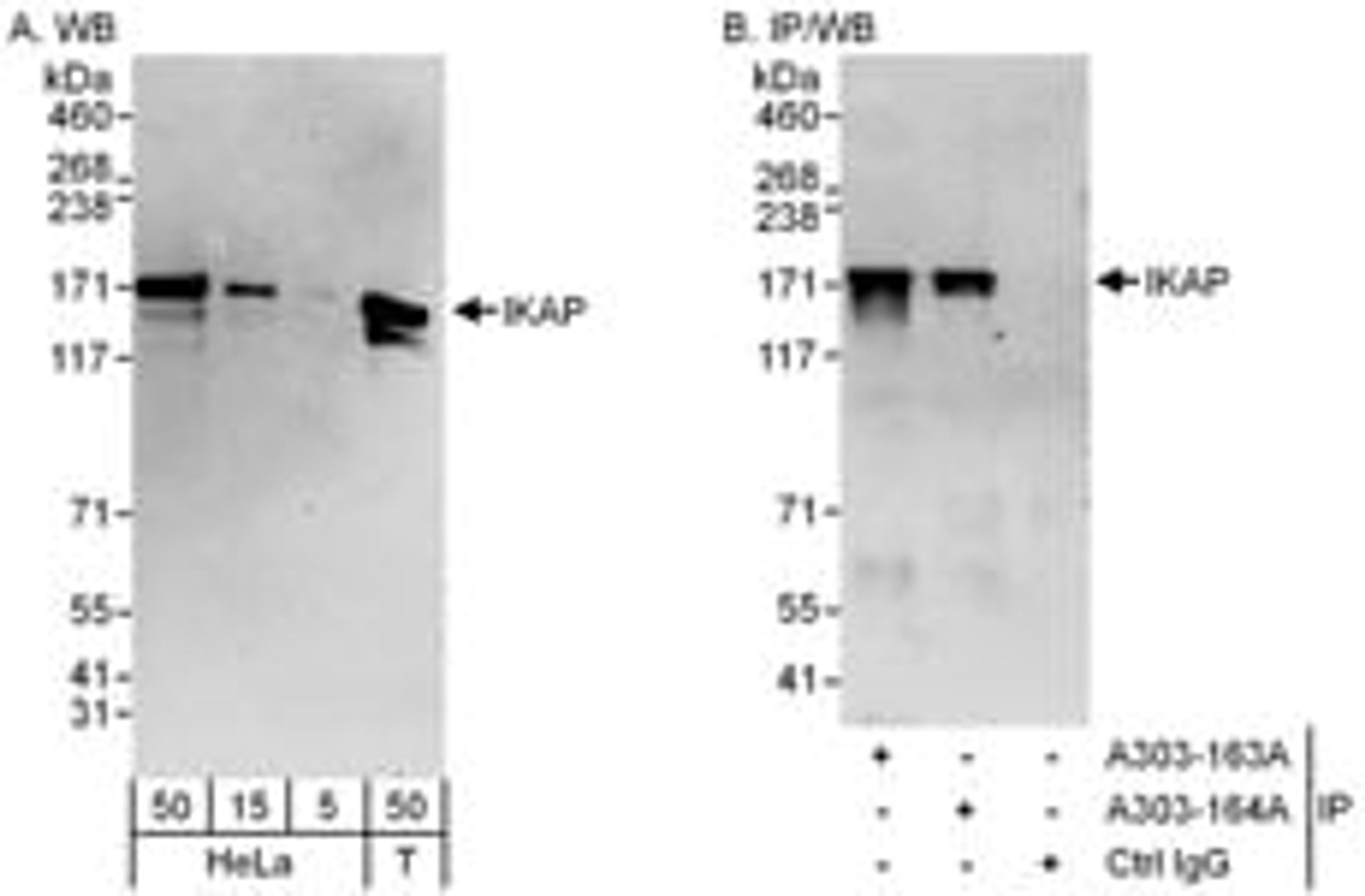 Detection of human IKAP by western blot and immunoprecipitation.