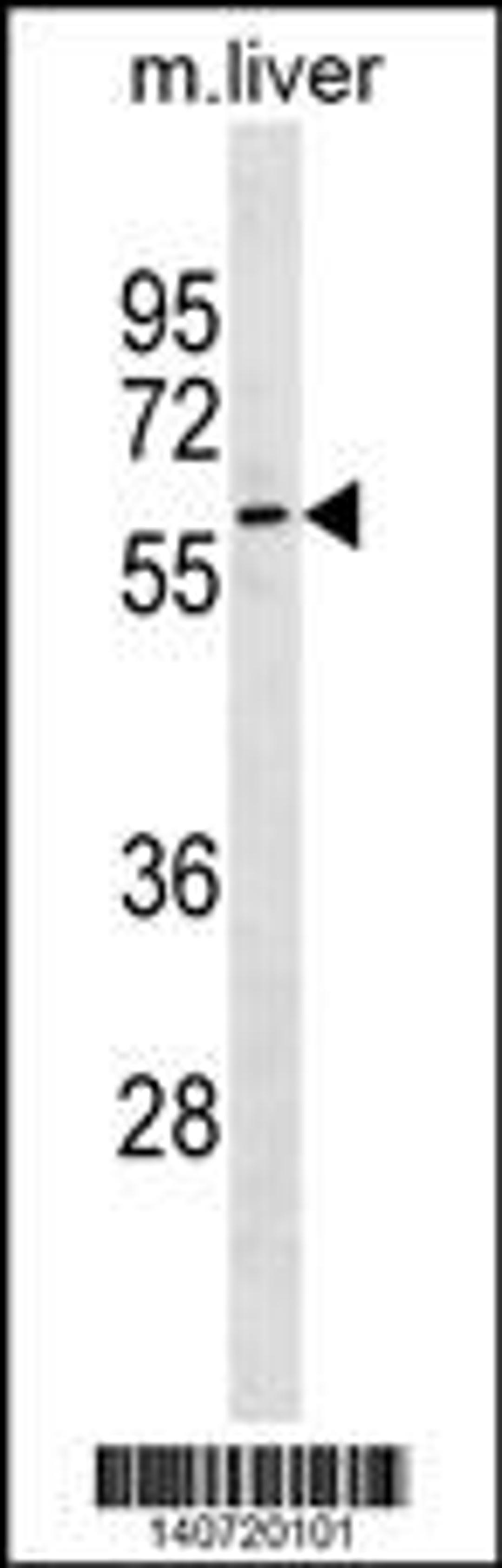 Western blot analysis in mouse liver tissue lysates (35ug/lane).