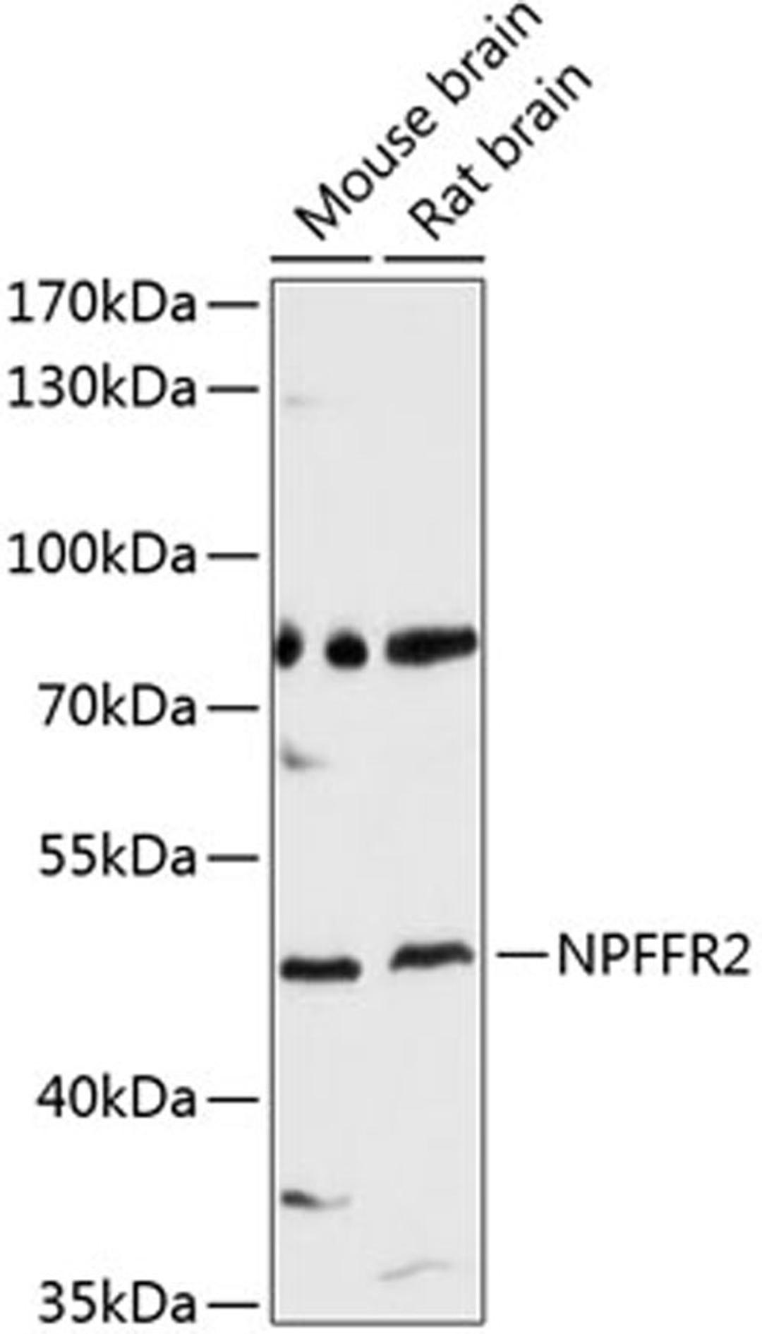 Western blot - NPFFR2 antibody (A10664)