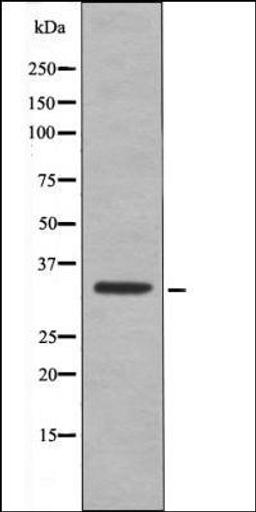 Western blot analysis of EGF treated 293 whole cell lysates using CDK1/CDC2 -Phospho-Thr161- antibody