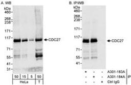 Detection of human CDC27 by western blot and immunoprecipitation.