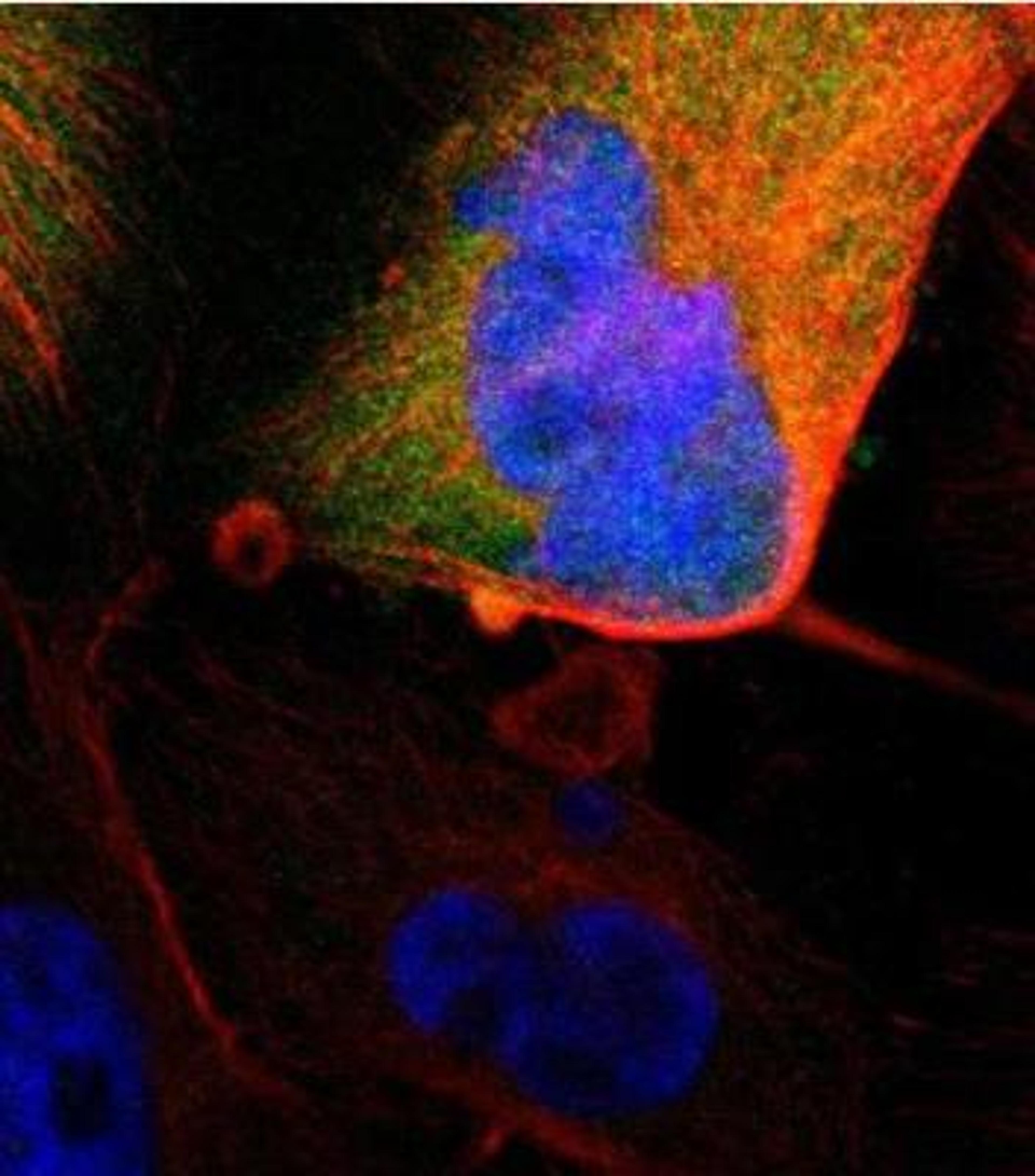 Immunocytochemistry/Immunofluorescence: MIF Antibody [NBP1-81832] - Staining of human cell line U-251 MG shows positivity in cytoplasm.