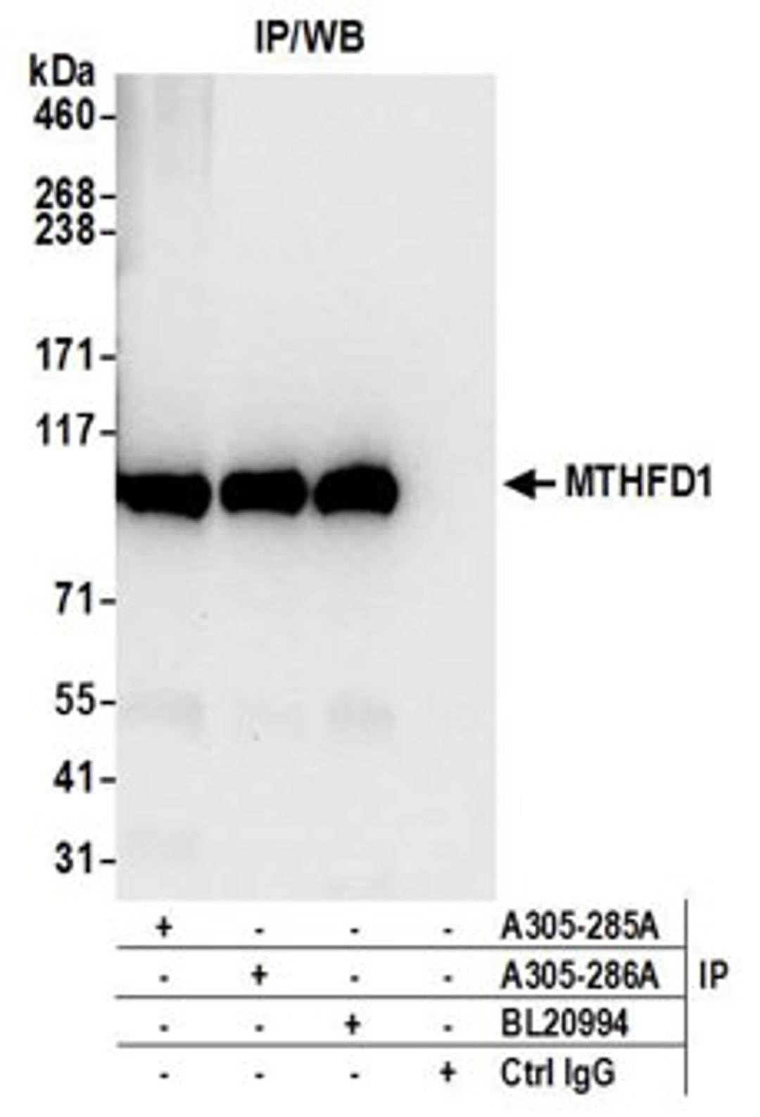 Detection of human MTHFD1 by western blot of immunoprecipitates.