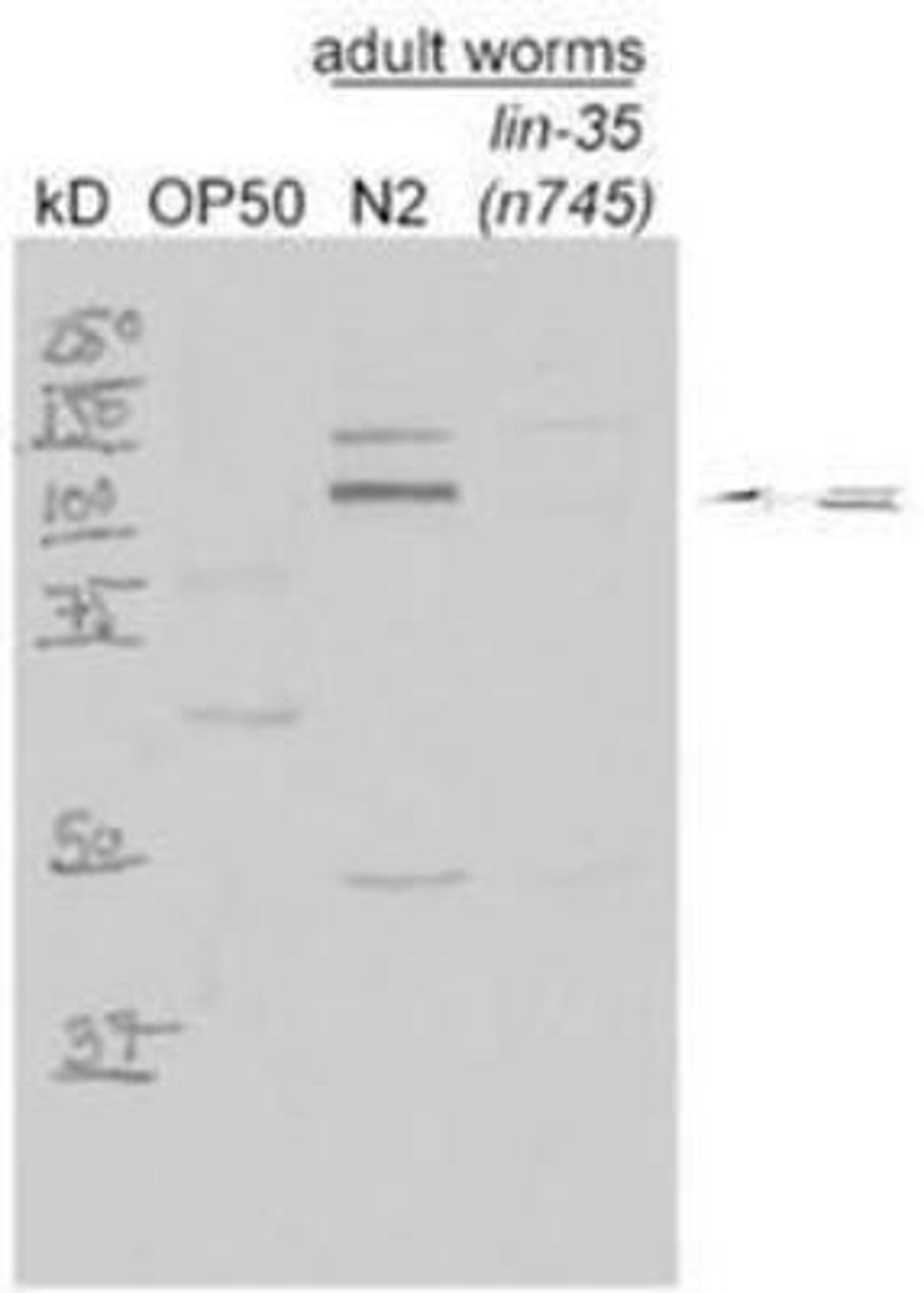 Western Blot: lin-35 Antibody [45160002]  This image is specific to animal number SDQ3232 1:2000 of 0.5 mg/ml stock