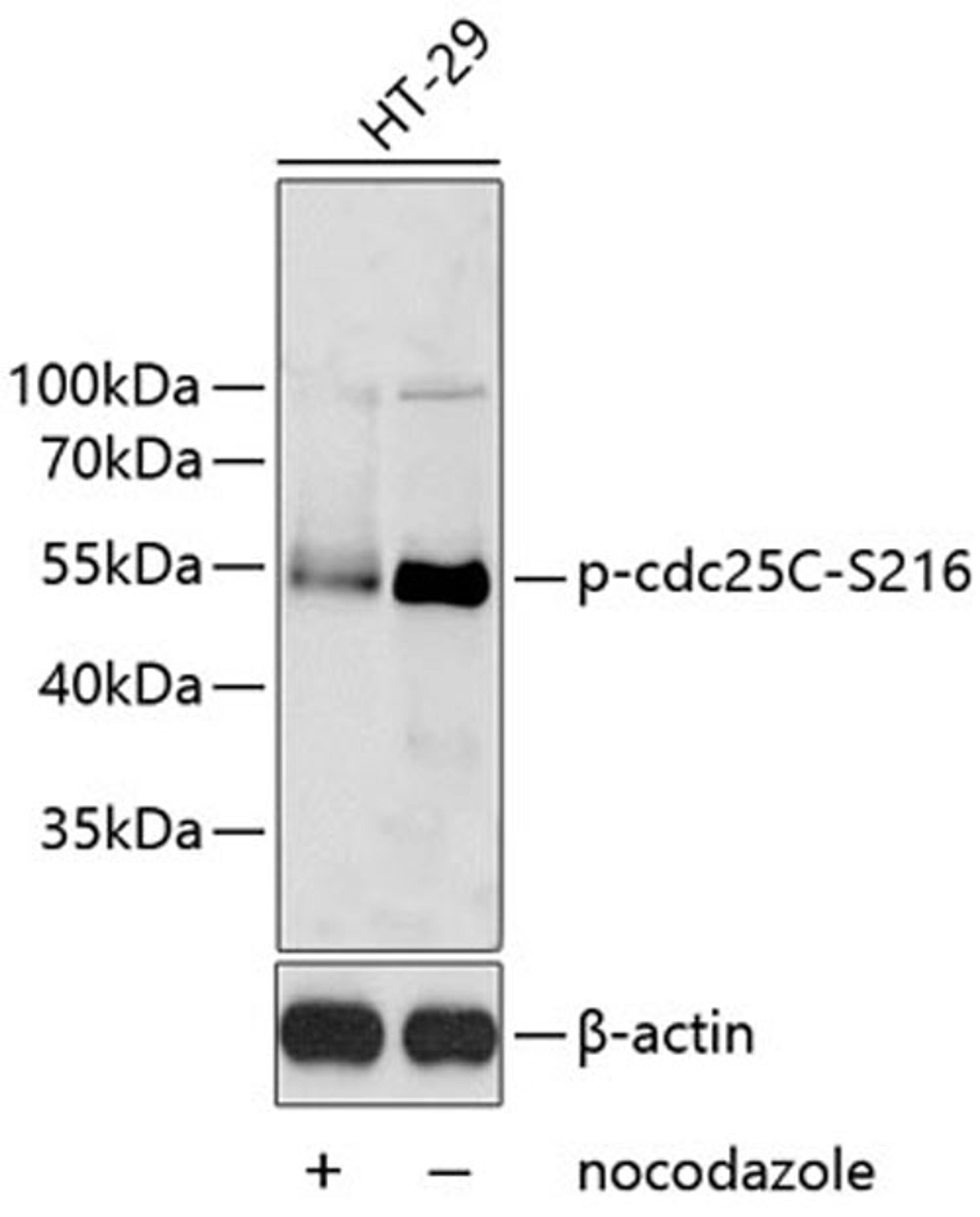 Western blot - Phospho-cdc25C-S216 antibody (AP0577)