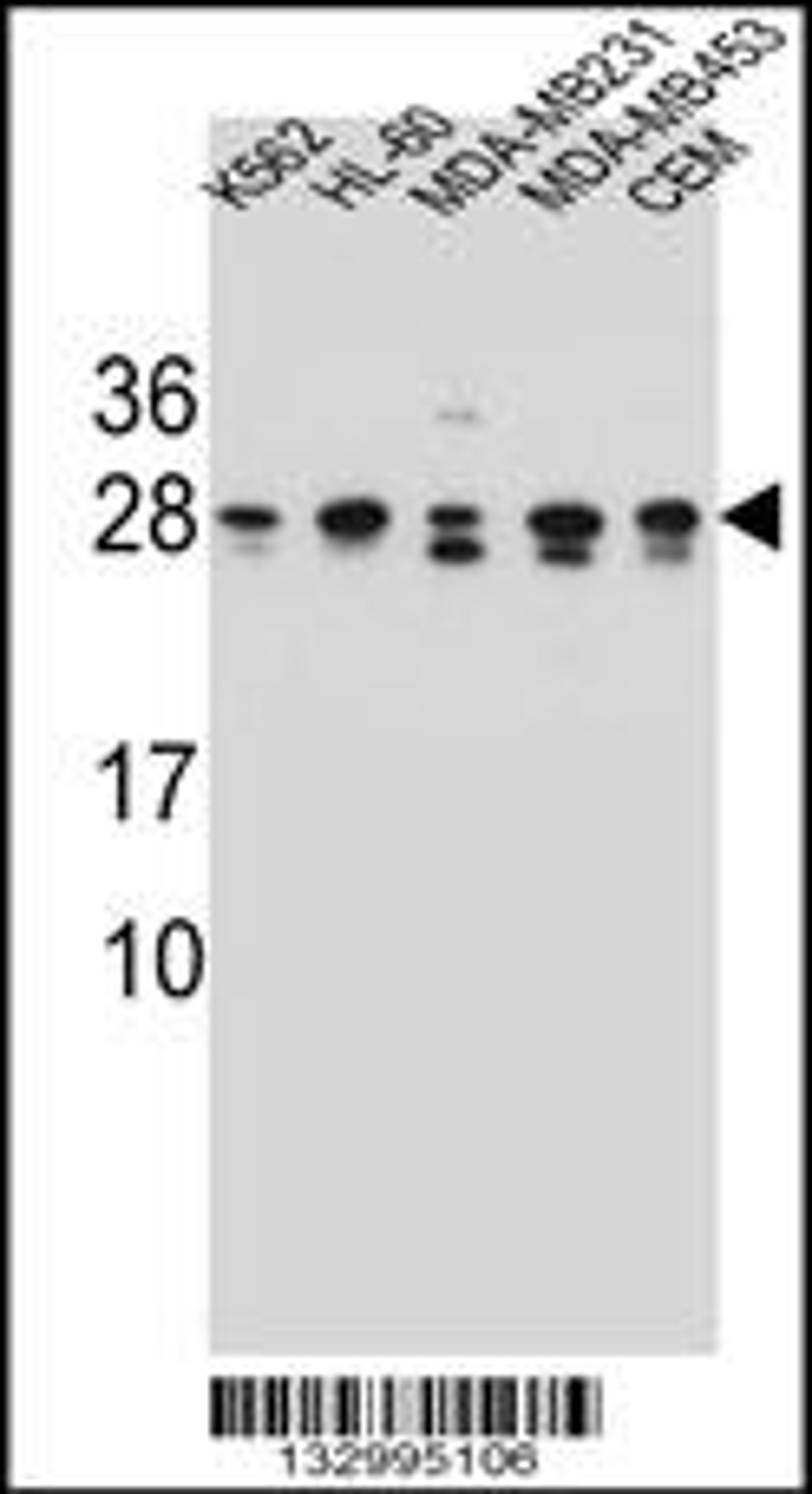 Western blot analysis in K562,HL-60,MDA-MB231,MDA-MB453,CEM cell line lysates (35ug/lane).