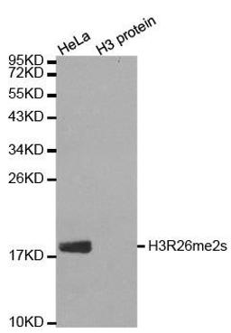 Western blot analysis of extracts of HeLa cell line and H3 protein expressed in E.coli using HIST1H3J antibody