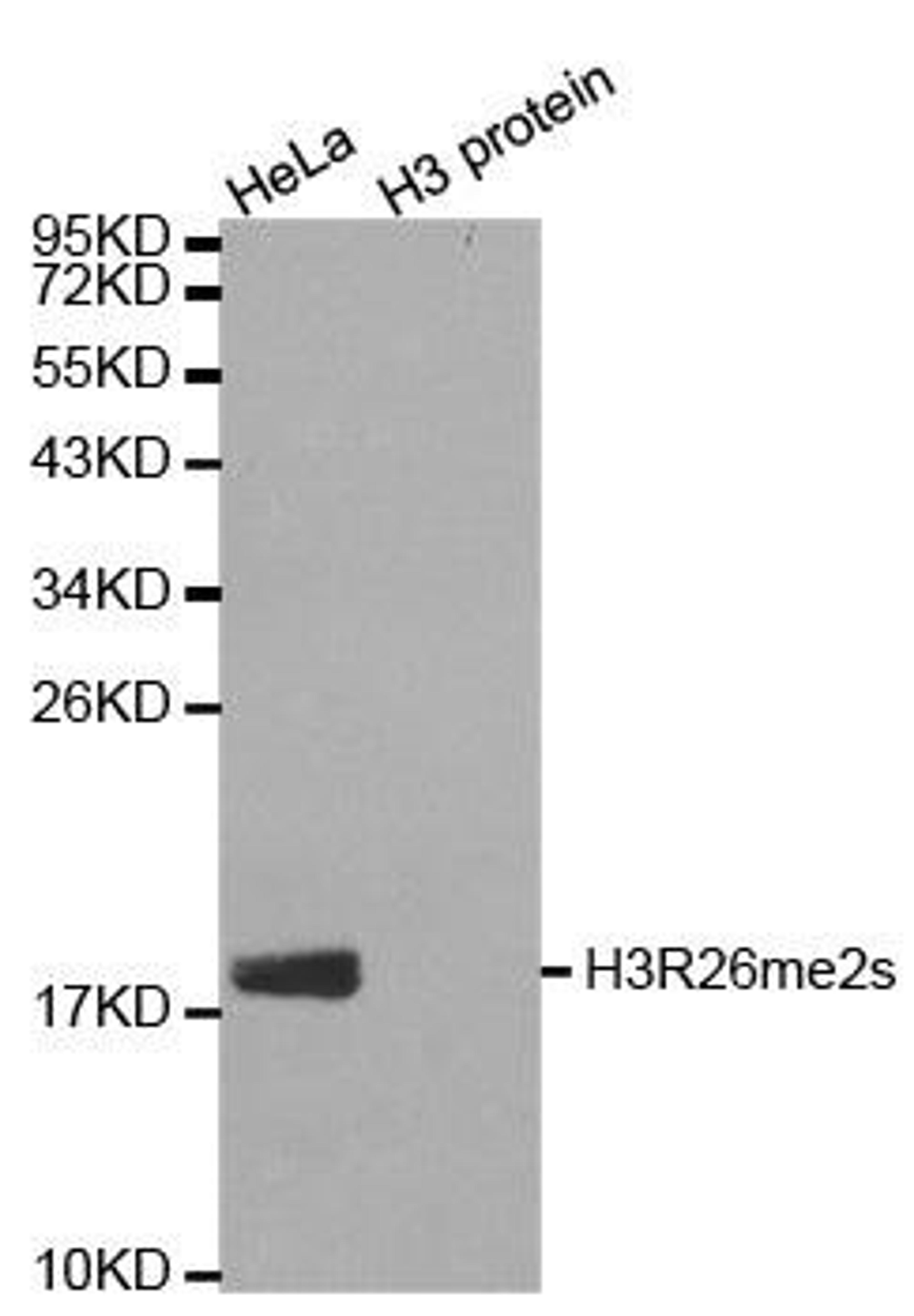 Western blot analysis of extracts of HeLa cell line and H3 protein expressed in E.coli using HIST1H3J antibody