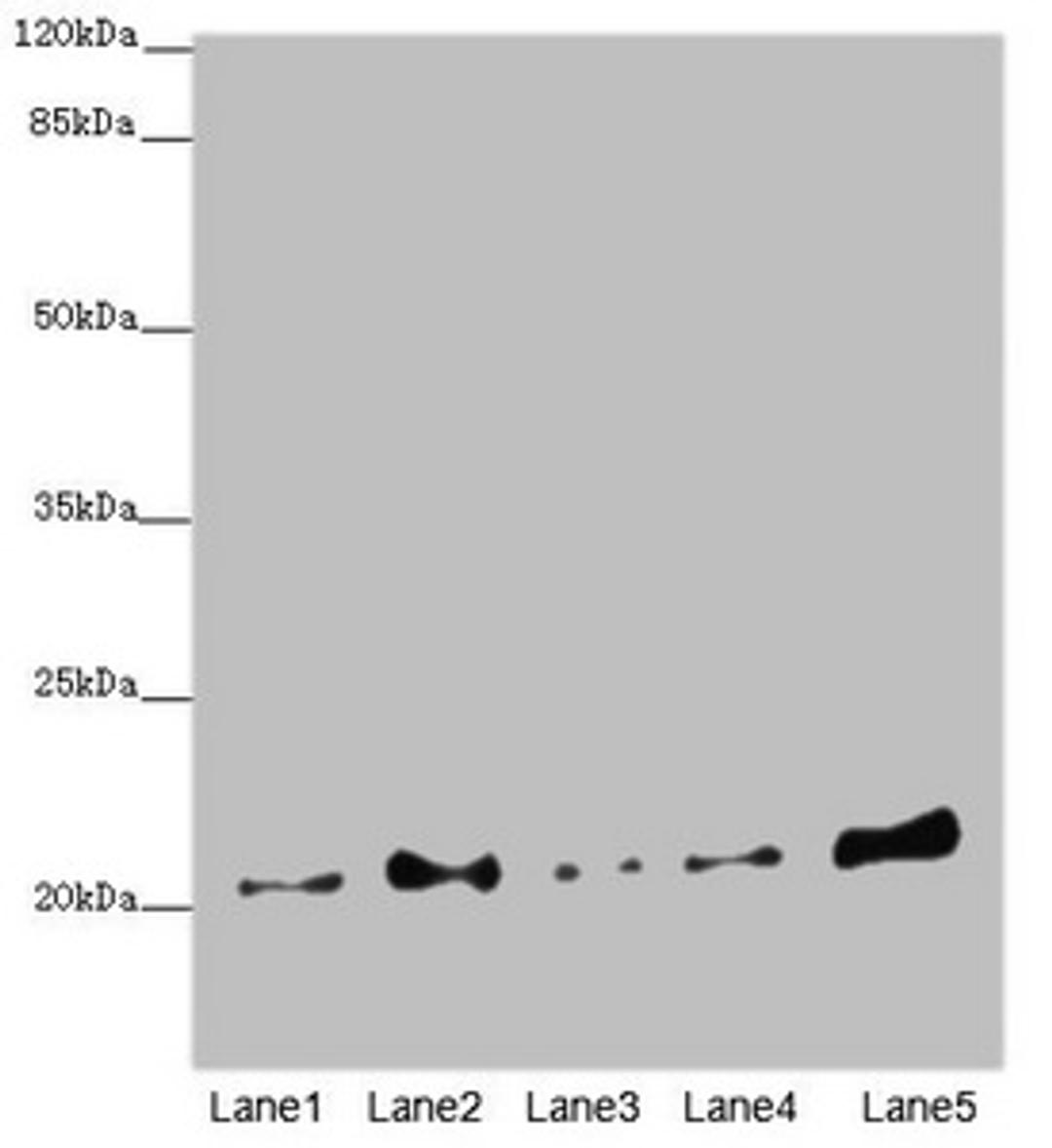Western blot. All lanes: COMMD1 antibody at 5.36µg/ml. Lane 1: A549 whole cell lysate. Lane 2: Jurkat whole cell lysate. Lane 3: MCF-7 whole cell lysate. Lane 4: Hela whole cell lysate. Lane 5: HepG2 whole cell lysate. Secondary. Goat polyclonal to rabbit IgG at 1/10000 dilution. Predicted band size: 22, 18 kDa. Observed band size: 22 kDa