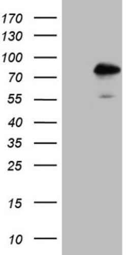 Western Blot: TR4/NR2C2 Antibody (4B1) [NBP2-46228] - Analysis of HEK293T cells were transfected with the pCMV6-ENTRY control (Left lane) or pCMV6-ENTRY NR2C2.