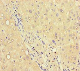 Immunohistochemistry of paraffin-embedded human liver tissue using CSB-PA836654LA01HU at dilution of 1:100