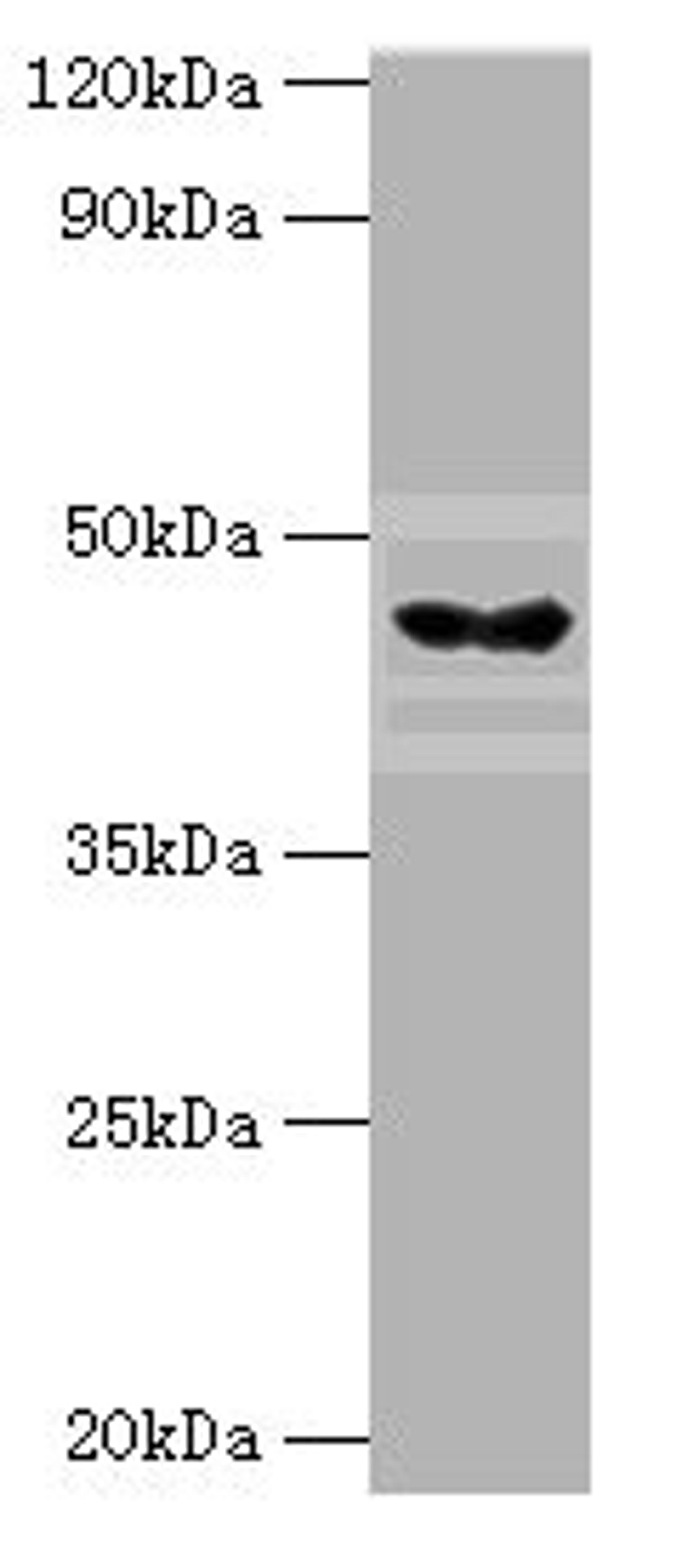 Western blot. All lanes: HYAL3 antibody at 4ug/ml + Mouse liver tissue. Secondary. Goat polyclonal to rabbit IgG at 1/10000 dilution. Predicted band size: 47, 44, 19, 16 kDa. Observed band size: 47 kDa. 