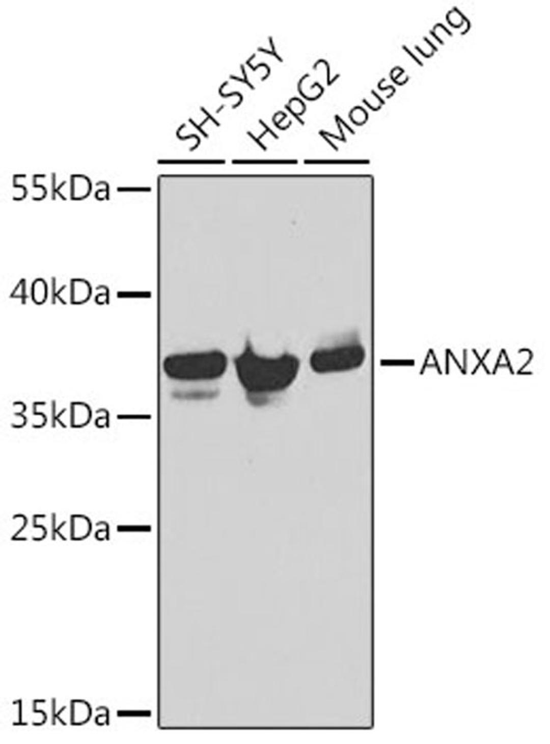 Western blot - ANXA2 Antibody (A12397)