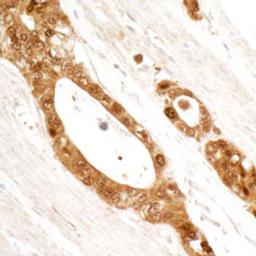 Detection of human 14-3-3 Sigma by immunohistochemistry.