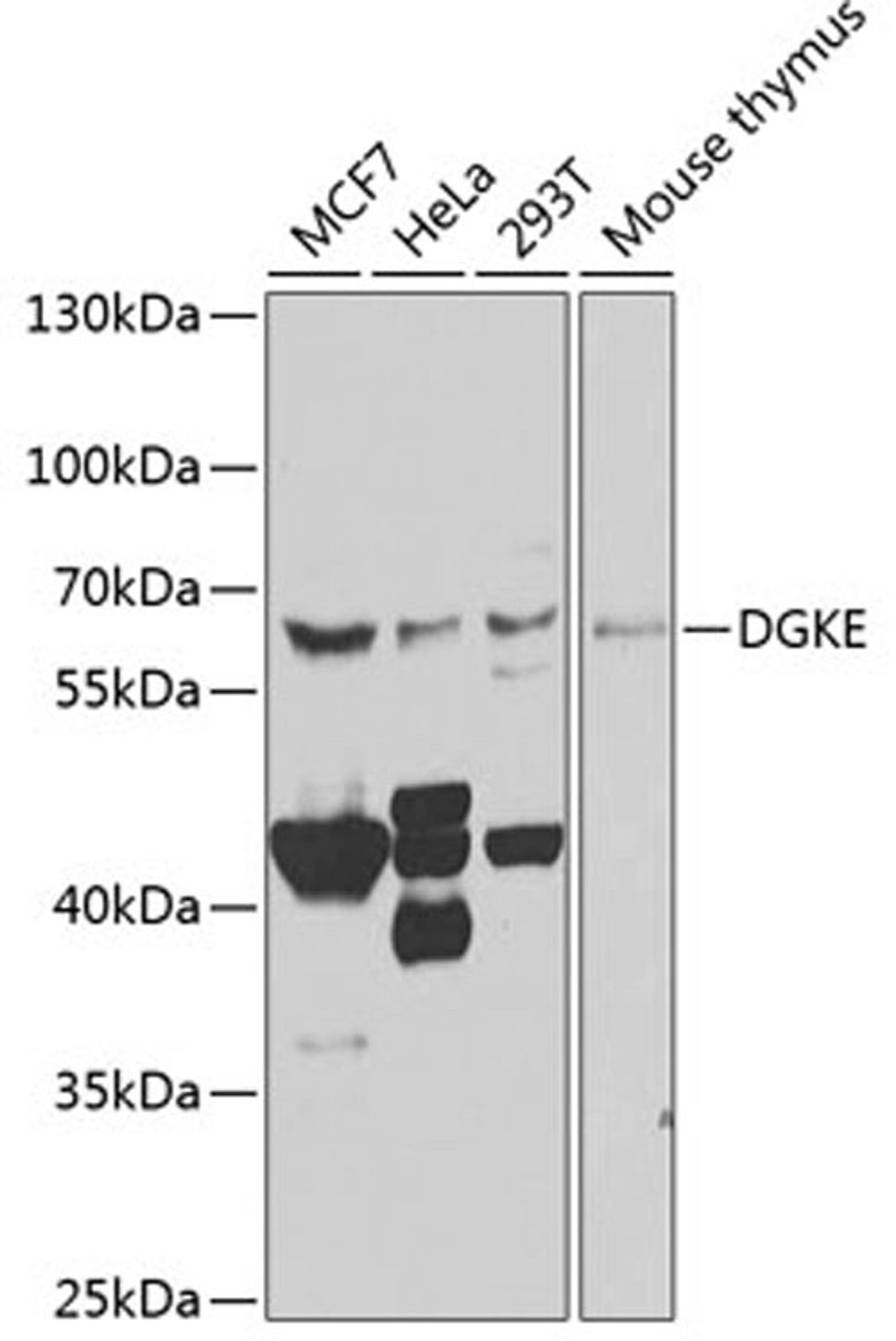 Western blot - DGKE antibody (A7752)