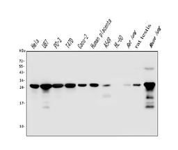 Western blot analysis of Galectin 3/LGALS3 using anti-Galectin 3/LGALS3 antibody