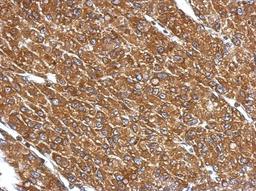 Immunohistochemistry-Paraffin: CYP27A1 Antibody [NBP2-16062] - Immunohistochemical analysis of paraffin-embedded U87 xenograft, using antibody at 1:500 dilution.