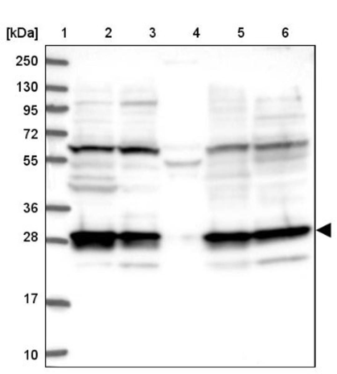 Western Blot: 26S proteasome subunit 9 Antibody [NBP2-47561] - Lane 1: Marker [kDa] 250, 130, 95, 72, 55, 36, 28, 17, 10.  Lane 2: Human cell line RT-4.  Lane 3: Human cell line U-251MG.  Lane 4: Human plasma (IgG/HSA depleted).  Lane 5: Human liver tissue.  Lane 6: Human tonsil tissue.